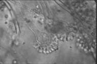 conidia2