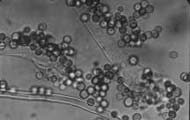 conidia2