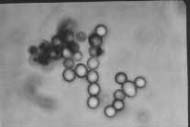 conidia3